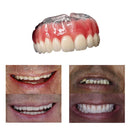 Dentadura de Silicone FIX | Ajustavel e Adaptativa